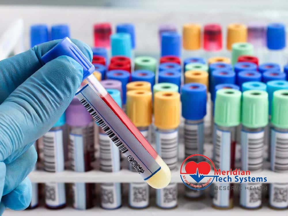 Blood Test Tubes Colors for Sale in Kampala Uganda. Blood Collection Tubes Colors, Lab-Laboratory Consumables Medical Devices and Equipment Uganda, Medical Supply, Medical Equipment, Hospital, Clinic & Medicare Equipment Kampala Uganda. Meridian Tech Systems Uganda, Ugabox